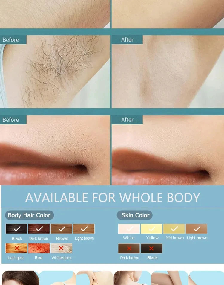 Body Bikini IPL 500,000 Flash Depilator Pulses Permanent Laser.